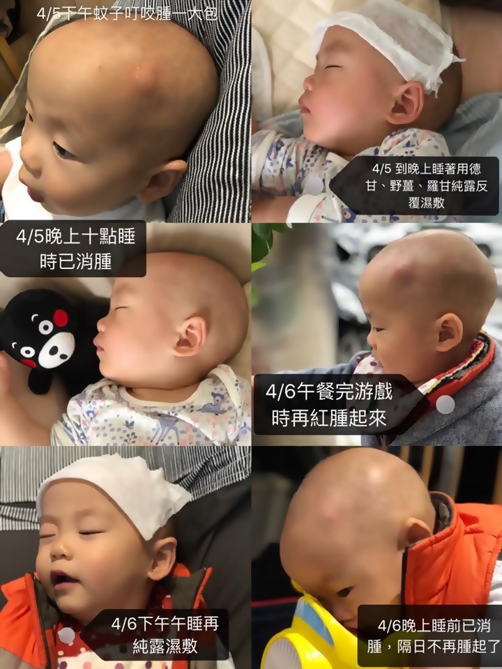 聽聽芳香~~會為小孩做精油使用紀錄的馥年 TWAA台灣芳療協會 圖片來源：受訪者提供